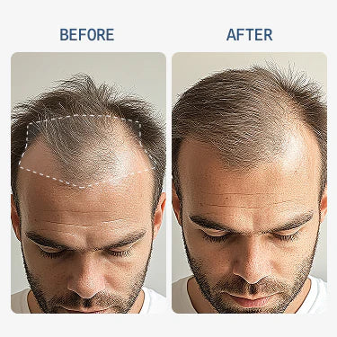 Advanced Copper Peptide Hair Regrowth Formula